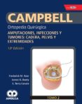 CAMPBELL ORTOPEDIA QUIRURGICA (TOMO 2): AMPUTACIONES, INFECCIONES Y TUMORES: CADERA, PELVIS Y EXTREMIDADES (INCLUYE E-BOOK) di AZAR 