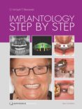 Implantology Step By Step (ebook)