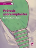 PROTESIS SOBRE IMPLANTES di FUERTES DOPICO, EVA MARIA 