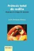 PROTESIS TOTAL DE RODILLA: AVANCES EN CIRUGIA DE REVISION di FERNANDEZ HERMOSO,JOSE A. 