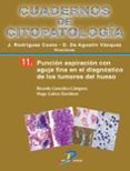 PUNCION ASPIRACION CON AGUJA FINA EN EL DIAGNOSTICO DE LOS TUMORE S DE HUESO di RODRIGUEZ COSTA, JULIO 