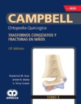 CAMPBELL ORTOPEDIA QUIRURGICA (TOMO 3): TRASTORNOS CONGENITOS Y FRACTUARS EN NIOS + E-BOOK, REFERENCIAS Y VIDEOS di AZAR 