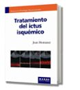 TRATAMIENTO DE ICTUS ISQUEMICO di MONTANER, JOAN 