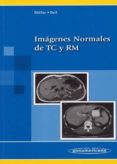IMAGENES NORMALES DE TC Y RM. de MLLER, TORSTEN B.  REIF, EMIL 
