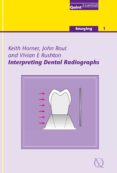 Interpreting Dental Radiographs (ebook)