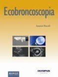 ECOBRONCOSCOPIA di ROSELL, ANTONI 