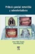 PROTESIS PARCIAL REMOVIBLE Y SOBREDENTADURAS di MALLAT DESPLATS, E.  MALLAT CALLIS, E. 