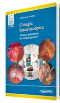 Cirugía laparoscópica