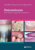 ONICOMICOSIS di ARENAS, ROBERTO 