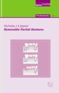 Removable Partial Dentures (ebook)
