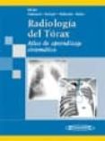 RADIOLOGIA DEL TORAX: ATLAS DE APRENDIZAJE SISTEMATICO di HOFER, MATTHIAS 