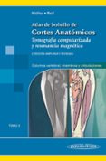 ATLAS CORTES ANATMICOS, 2 ED T3 di MLLER, TORSTEN B. 