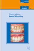 Dental Bleaching (ebook)