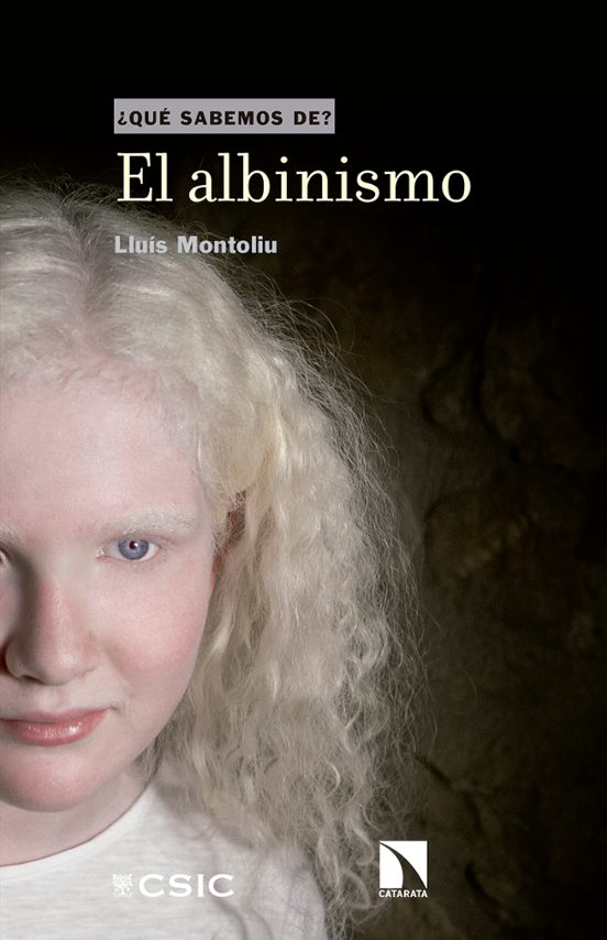 El Albinismo ¿que Sabemos De?
