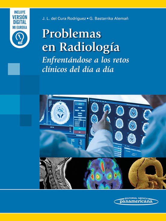 Problemas En Radiología
