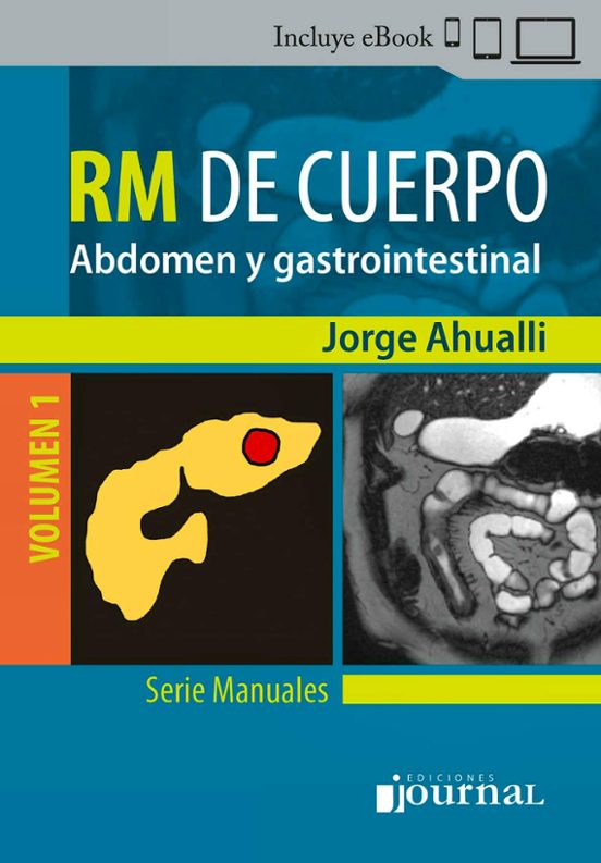 Manual De Rm De Cuerpo. Vol. 1: Abdomen Y Gastrointestinal