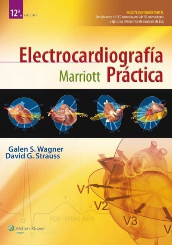 Electrocardiografía Práctica