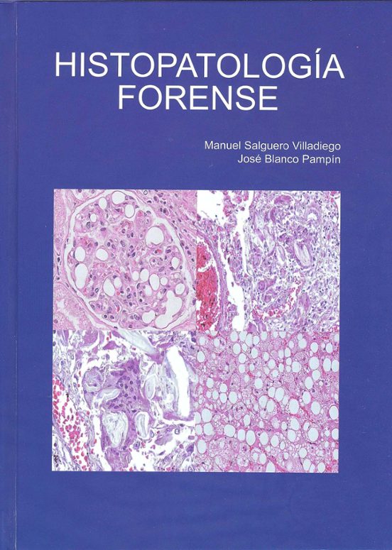 Histopatología Forense