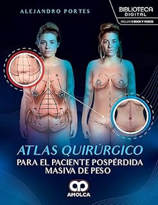 Atlas Quirúrgico Para El Paciente Pospérdida Masiva De Peso