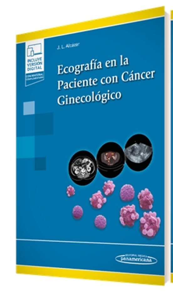 Ecografía En La Paciente Con Cáncer Ginecológico