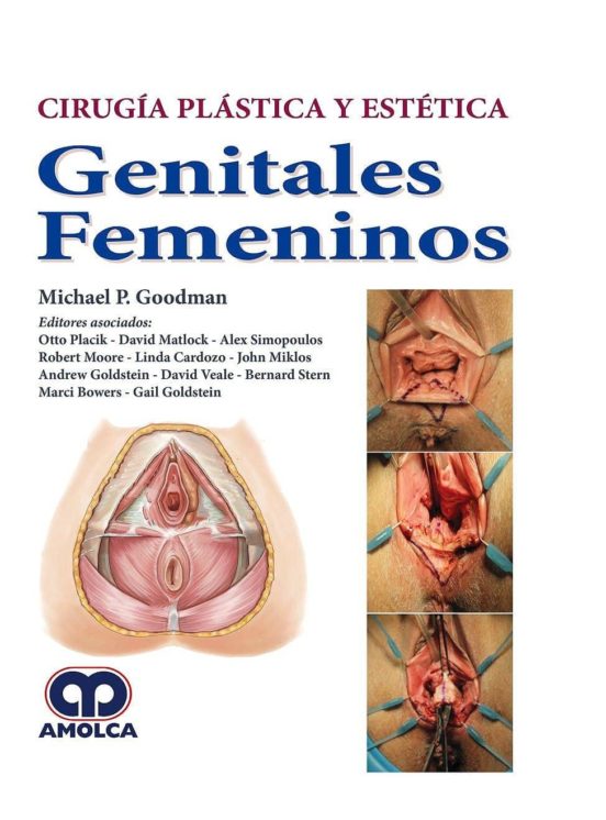 Cirugia Plastica Y Estetica: Genitales Femeninos