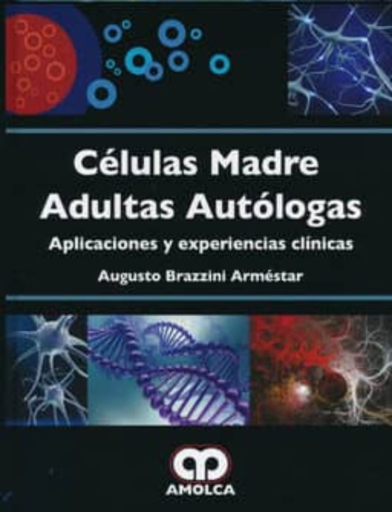 Celulas Madre Adultas Autologas: Aplicaciones Y Experiencias Clinicas