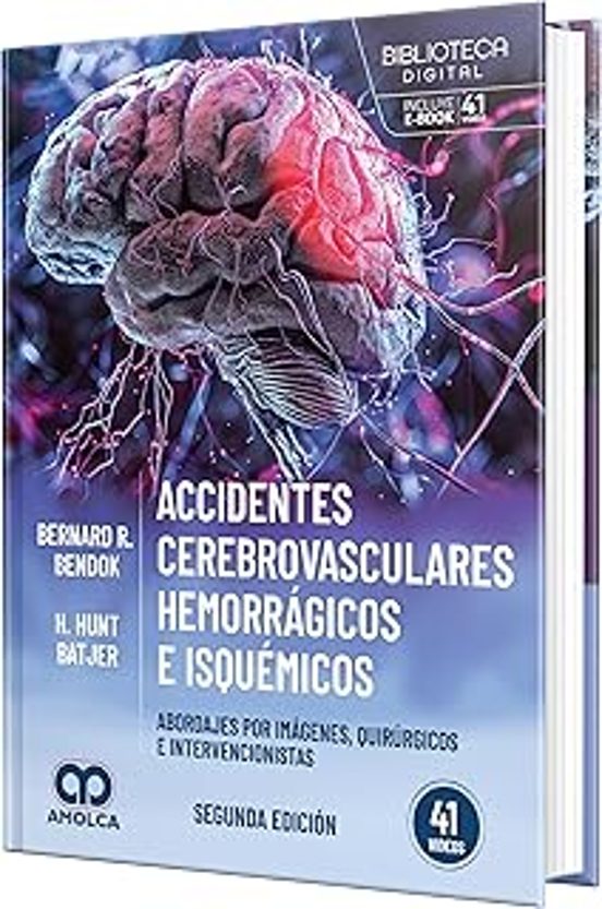 Accidentes Cerebrovasculares Hemorrágicos E Isquemicos