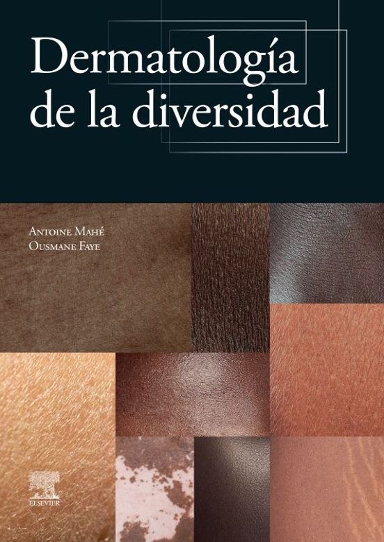 Dermatología De La Diversidad