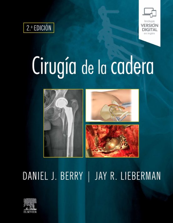 Cirugía De La Cadera