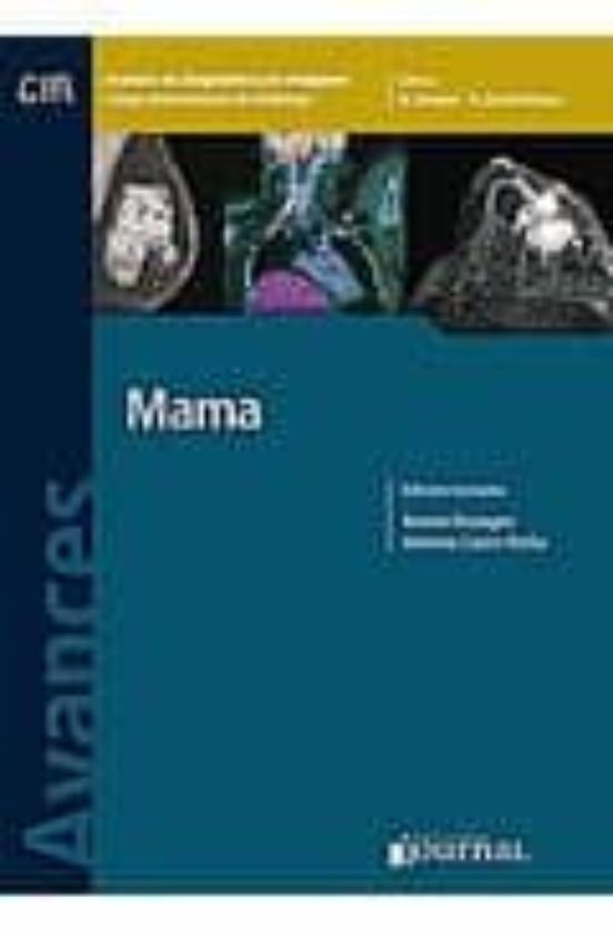 Avances En Diagnostico Por Imagenes 5: Mama