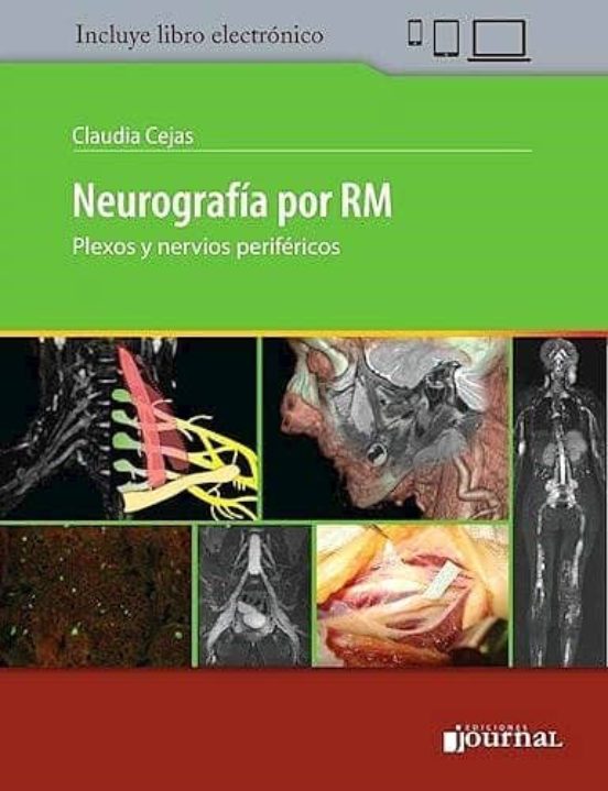 Neurografia Por Rm. Plexos Y Nervios Perifericos