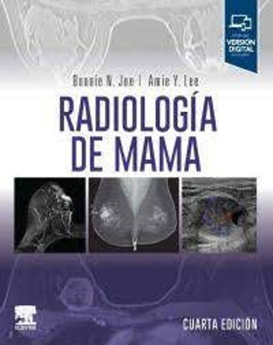 Radiología De Mama