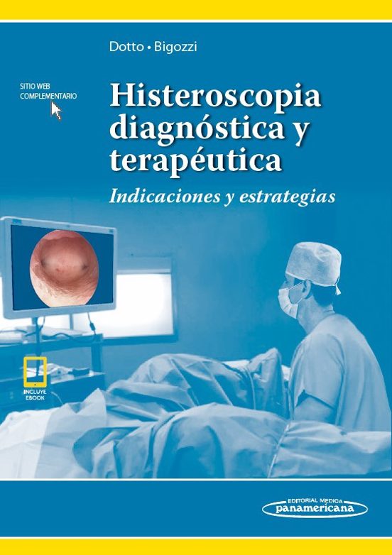 Histeroscopia Diagnostica Y Terapeutica: Indicaciones Y Estrategias