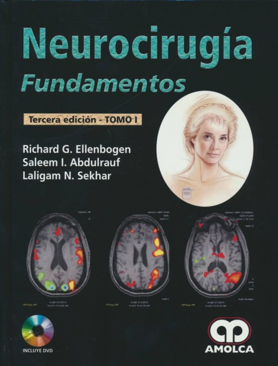 Neurocirugia: Fundamentos