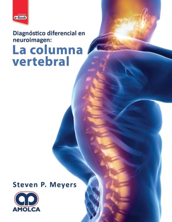 Diagnostico Diferencial En Neuroimagen. La Columna Vertebral