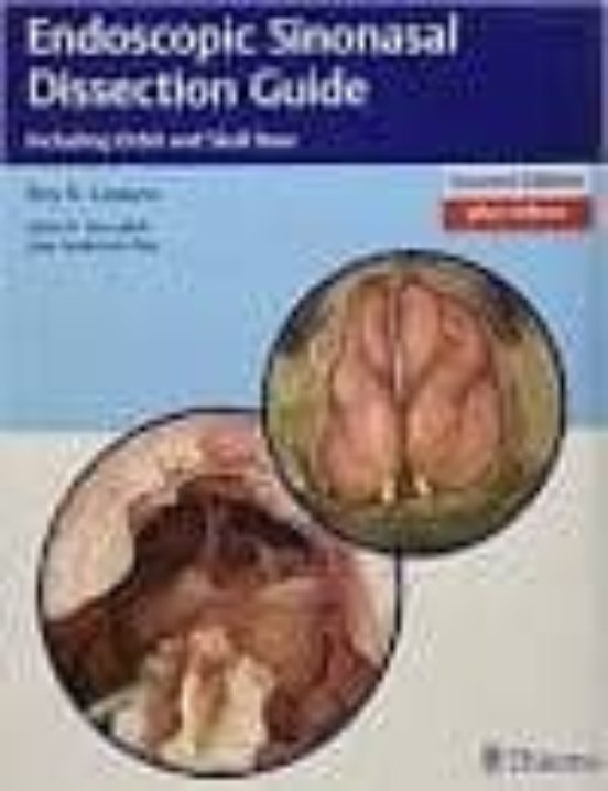 Endoscopic Sinonasal Dissection Guide 2º Ed