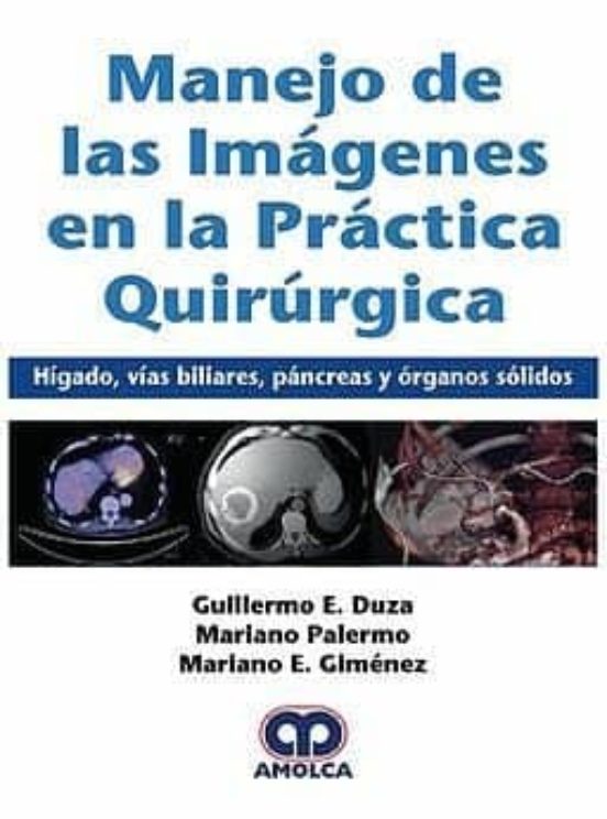 Manejo De Las Imagenes En La Práctica Quirurgica. Higado Vias Biliares