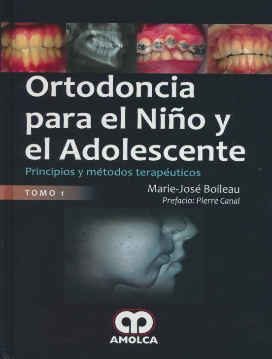 Ortodoncia Para El Niño Y El Adolescente: Principios Y Metodos Terapeu