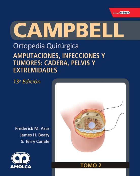 Campbell Ortopedia Quirurgica : Amputaciones Infecciones Y Tum