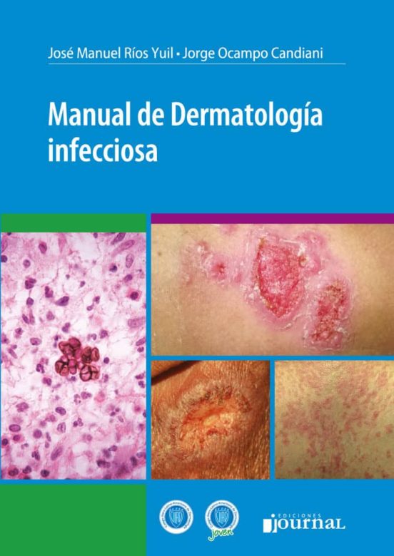 Manual De Dermatologia Infecciosa