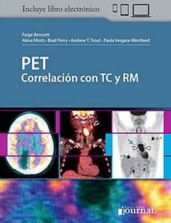 Pet Correlacion Con Tc Y Rm