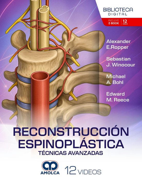 Reconstrucción espinoplástica. Técnicas avanzadas