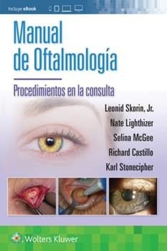 Manual De Oftalmología