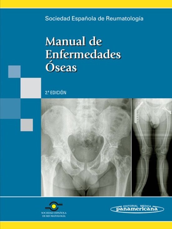 Manual De Enfermedades Oseas