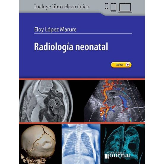 Radiología Neonatal