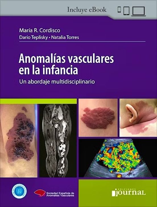 Anomalías Vasculares En La Infancia