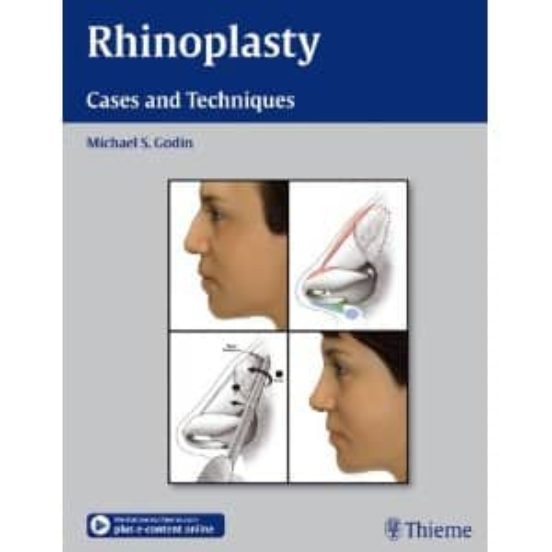 Rhinoplasty: Cases And Techniques