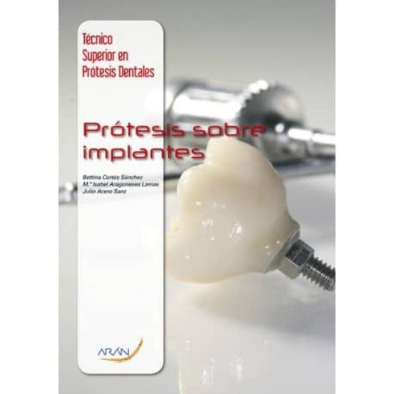 Protesis Sobre Implantes