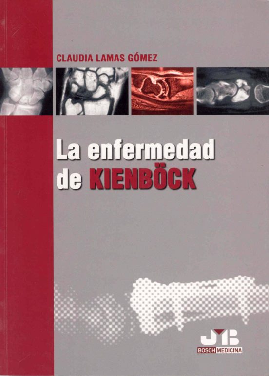 Enfermedad De Kienböck