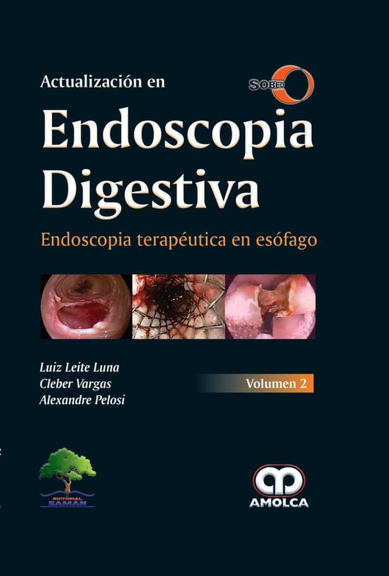 Actualizacion En Endoscopia Digestiva: Endoscopia Terapeutica En Esofa